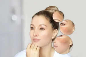 Estetik Kök Hücre Tedavisi